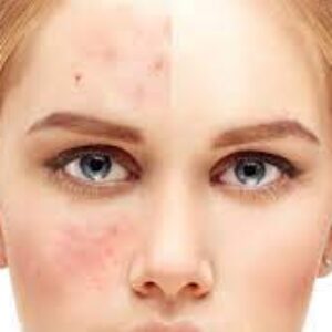 شایع ترین مشکلات پوستی