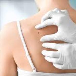 مشکلات پوستی که سخت درمان میشوند