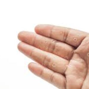 تشخیص مشکلات پوستی