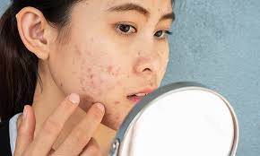 چه بیماری‌های پوستی بر سلامت روان تأثیر می‌گذارند؟