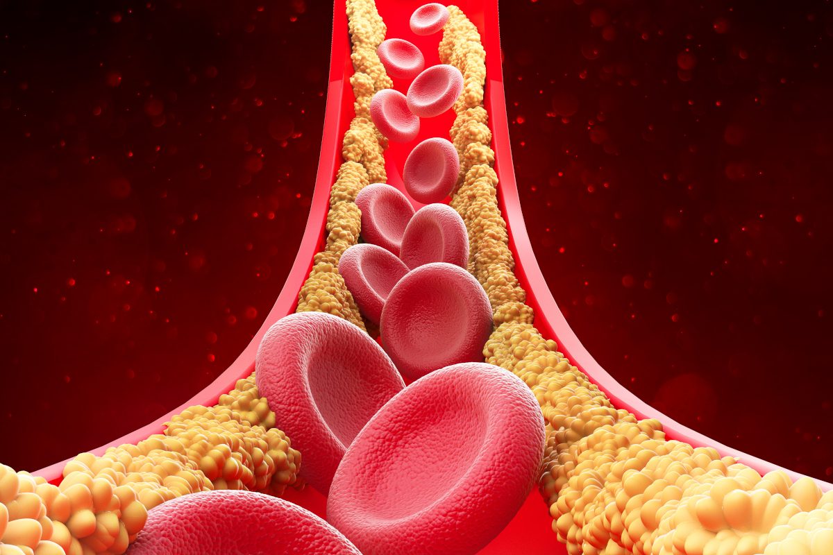چه غذاهایی در کاهش کلسترول کمک میکنند؟