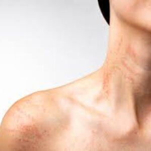 انواع عفونتهای پوستی کدامند؟