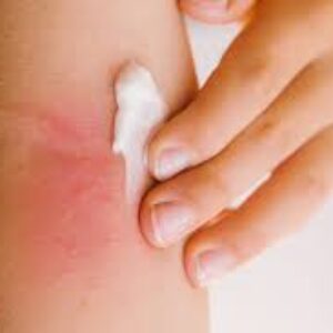 علائم عفونت پوستی چیست؟