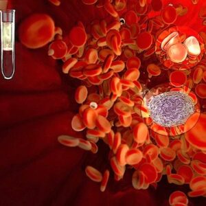 کم‌خونی به‌عنوان یکی از عوارض HIV